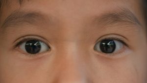 Can Head Lice Live in Eyebrows or Eyelashes?