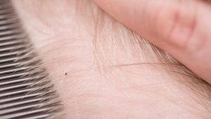 Young boy scratching his scalp through short hair after a head lice exposure