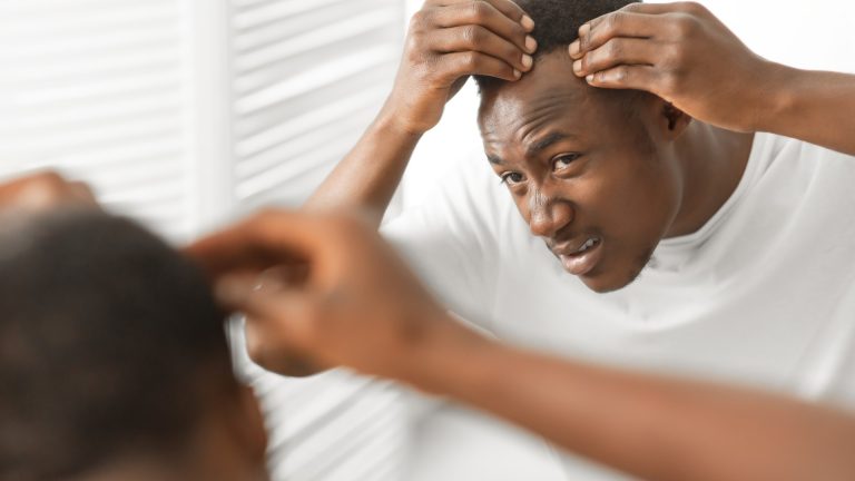 Why Are Lice So Easy to Miss in Textured Hair?