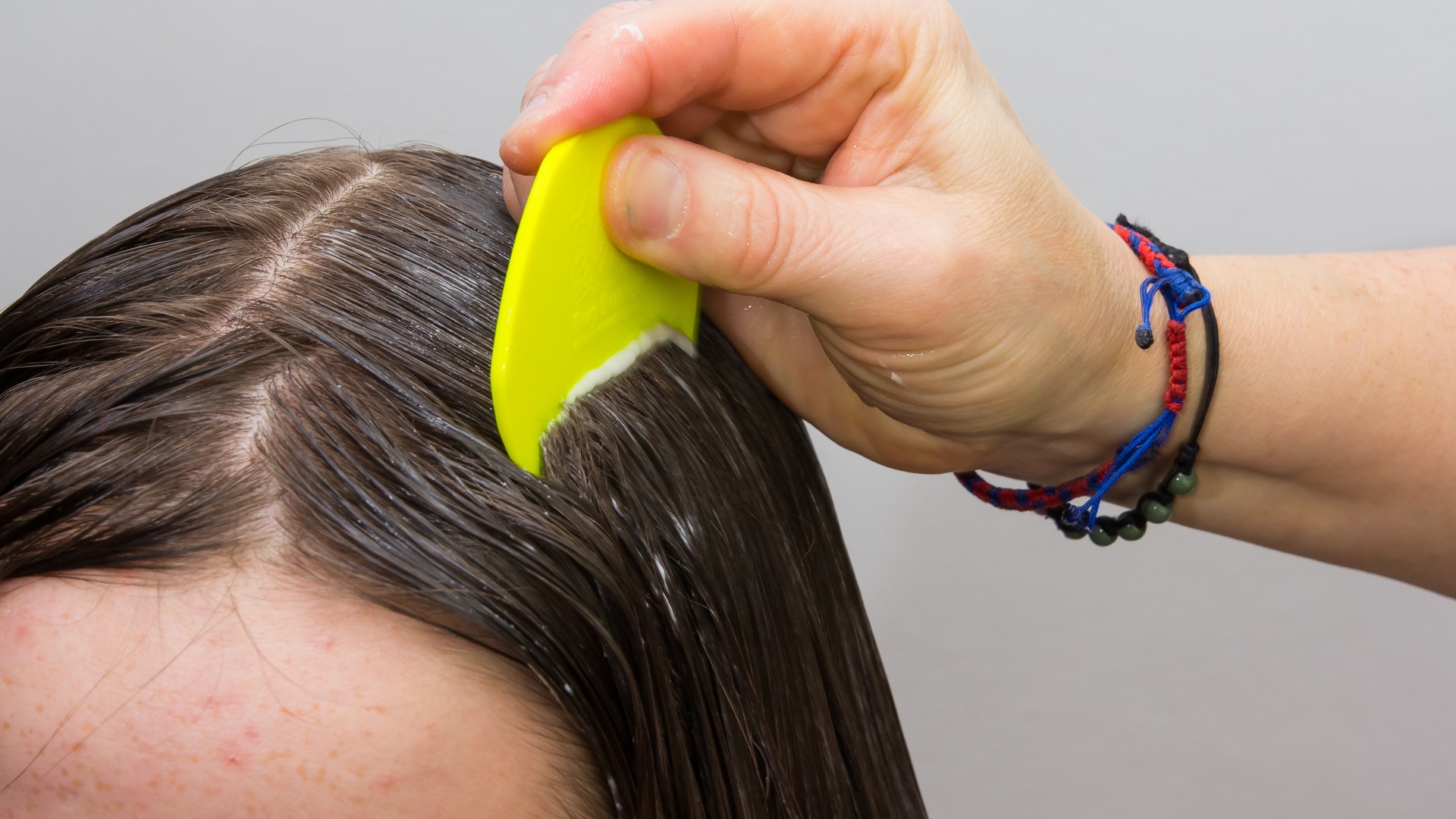 Will Daily Repellent Sprays Actually Stop Lice?