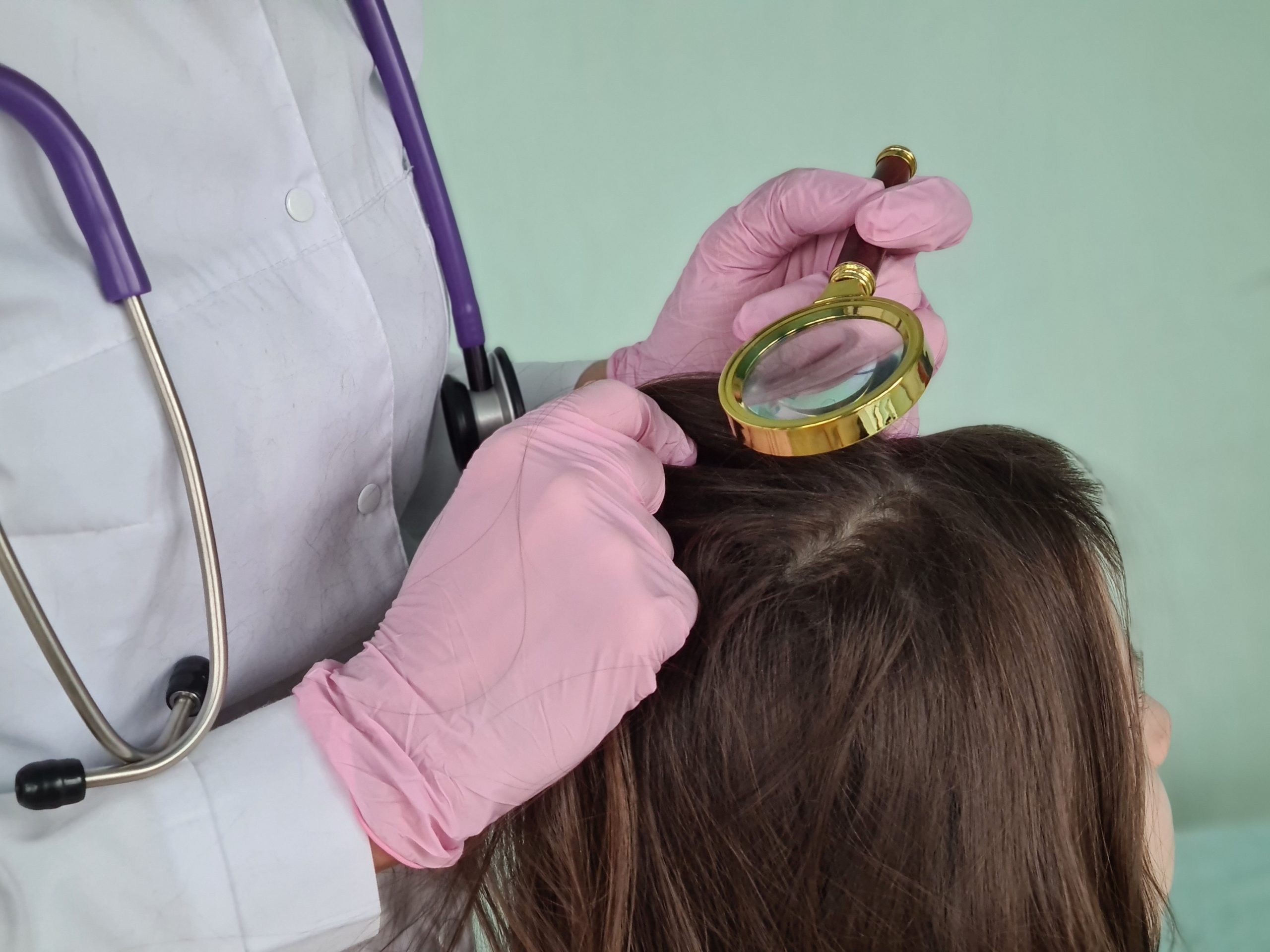 Lice Treatment Options Near the DC Beltway: A Local Guide featured image