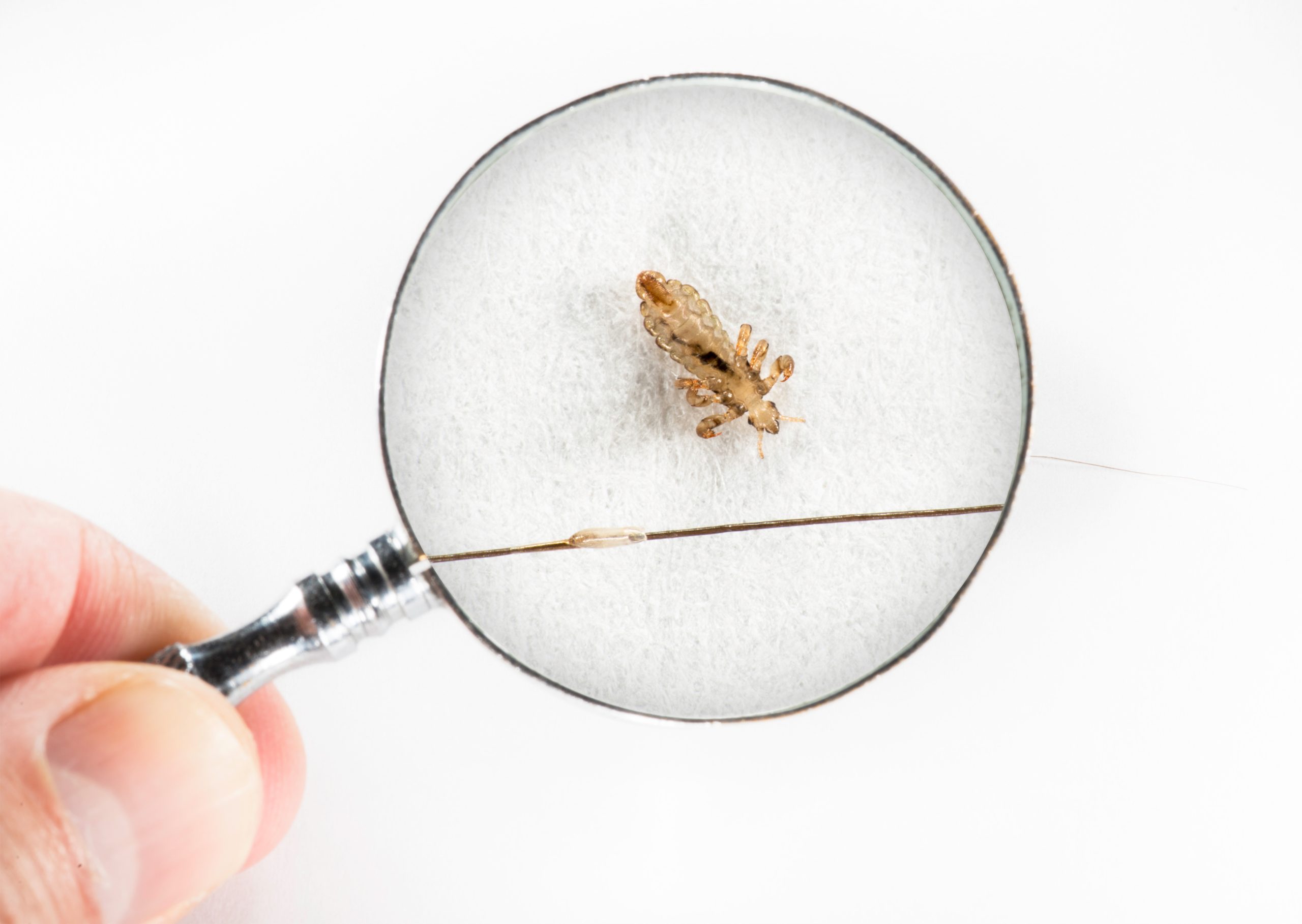 Magnified head lice and eggs for a life cycle article