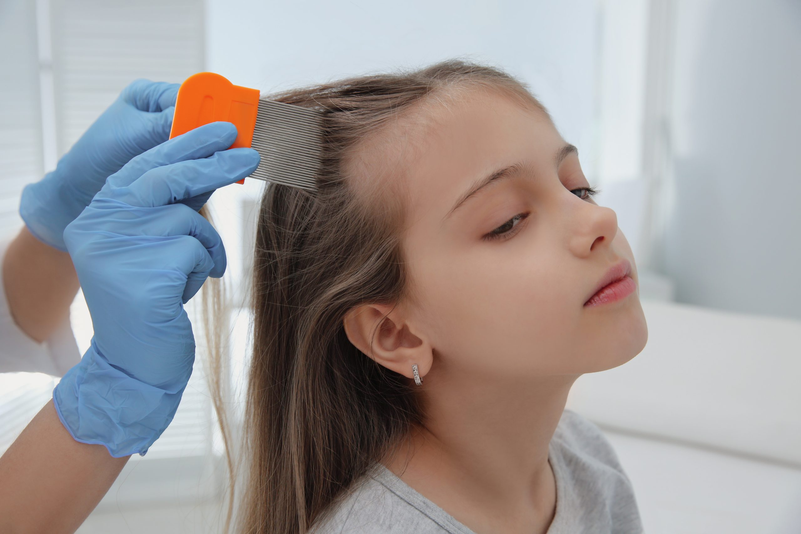 How to Get Rid of Lice Naturally Forever featured image