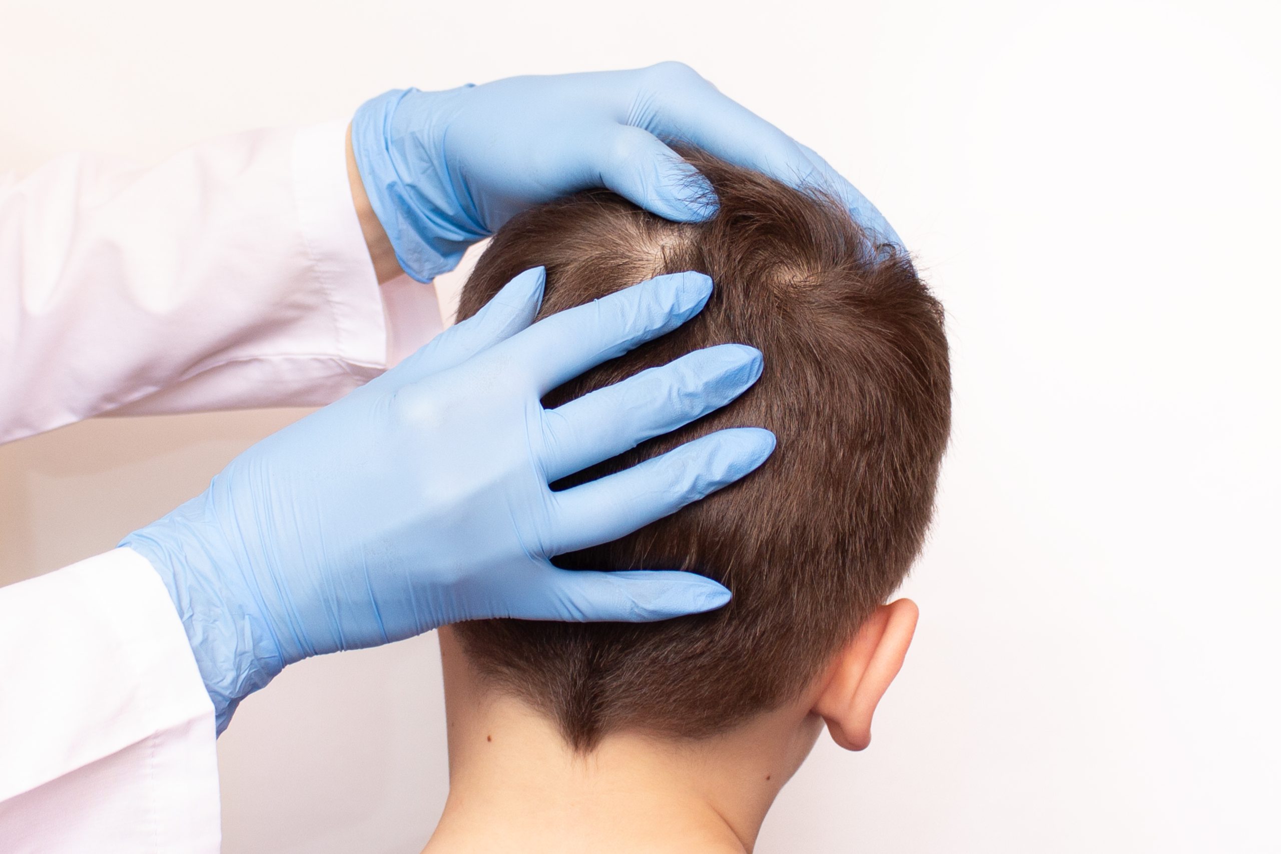 Doctor checking a young child's scalp for lice and nits