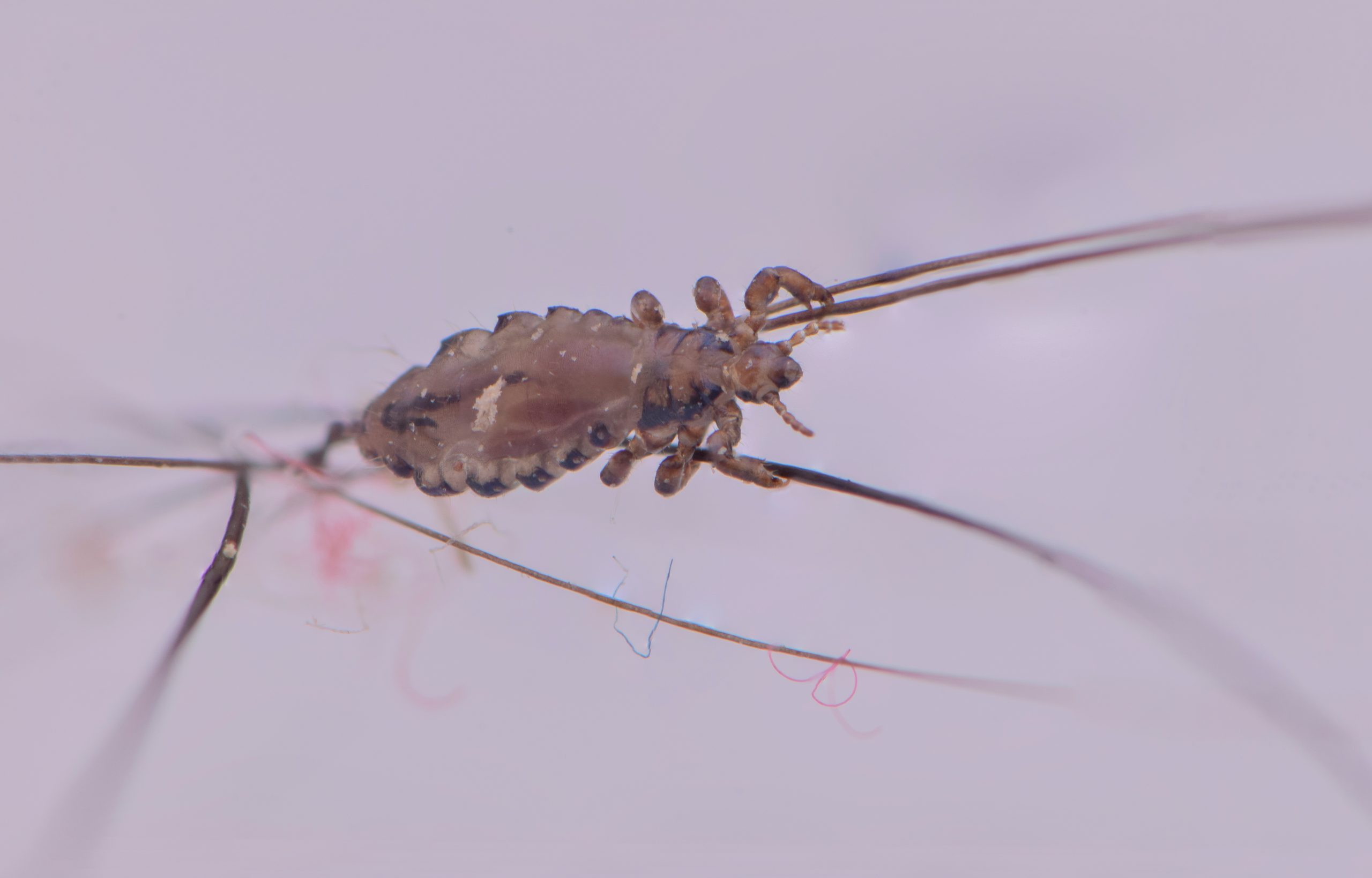 Macro close-up of a head louse