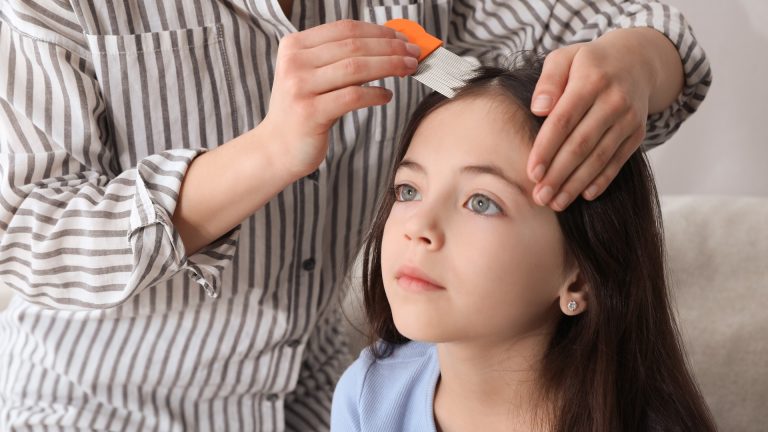 August 17 Starts Lice Season for Greater Washington Families
