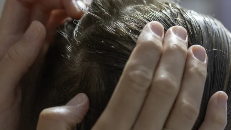 Booklice at home? A Silver Spring head check answers the scalp question